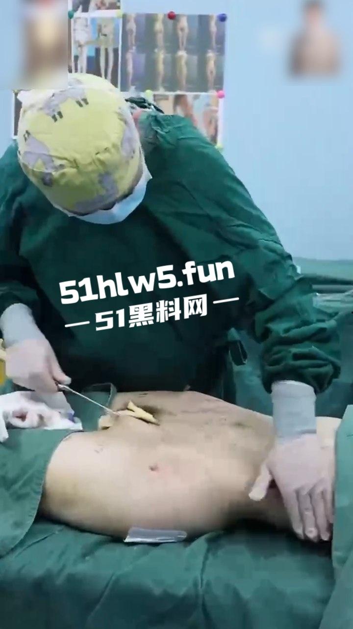 实拍整形医院,小仙女整容抽脂和填充全过程,看着残忍但做完后惊艳的效果让人震撼。-2